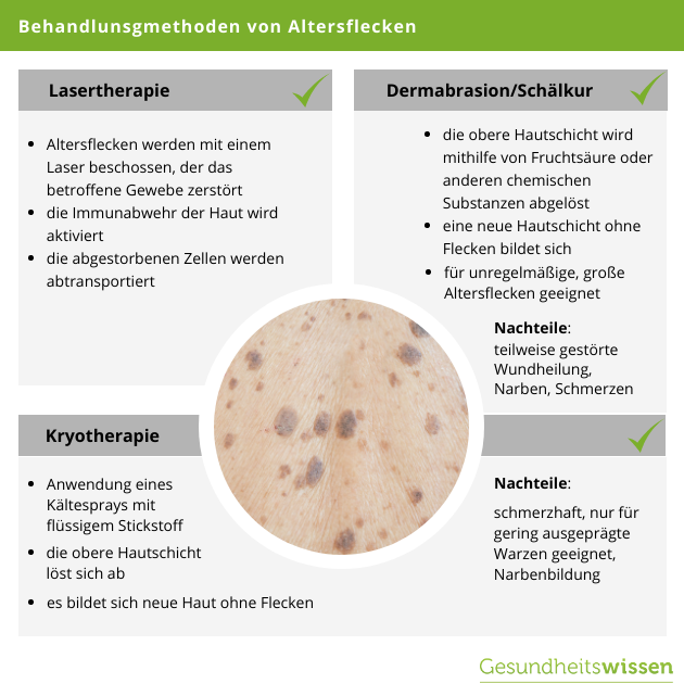 Altersflecken