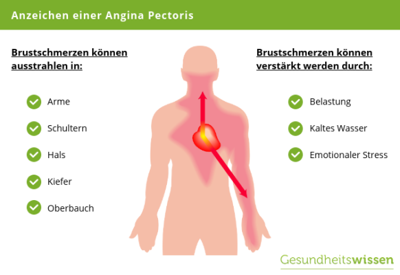 Ist Angina Ansteckend Für Erwachsene www.gesundheitswissen.de