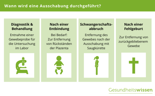 Das sollten SIe zum Thema Ausschabung wissen