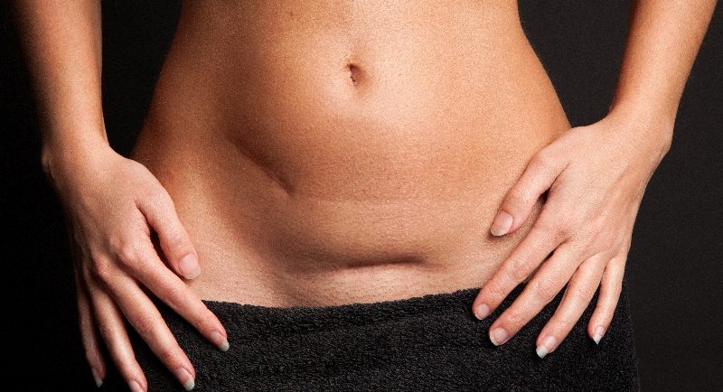 Gebärmutterkrebs: Ursachen, Symptome & Behandlung