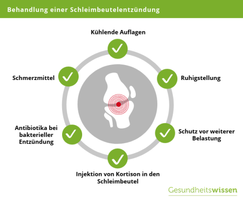 Schleimbeutelentzündung (Bursitis) - Ursachen, Symptome & Behandlung