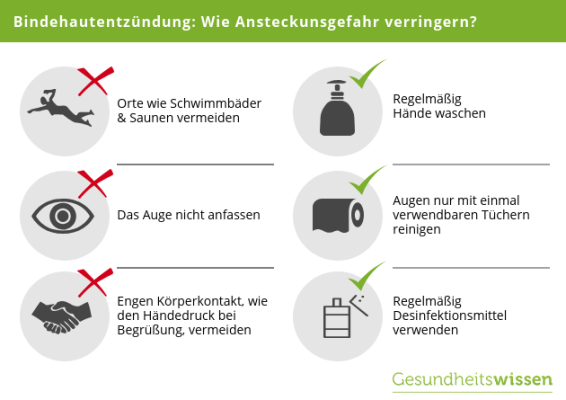 Bindehautentzündung: Symptome, Ursachen & Behandlungen