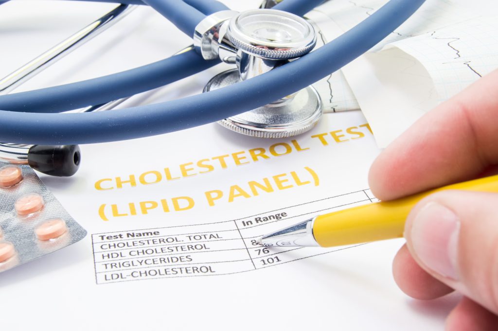 Cholesterinwert, Cholesterin, Ernährung, Ernährungstipps, Krankheiten