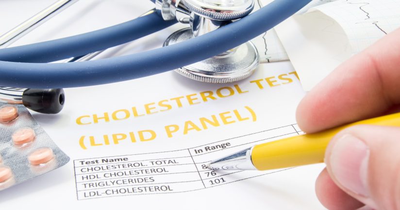 Cholesterin: Die wirksamsten pflanzlichen Senker