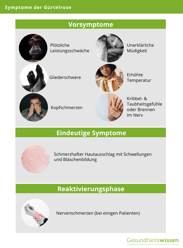 Gürtelrose Symptome