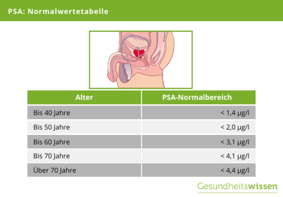 Was Ist Ein Guter Psa Wert www.gesundheitswissen.de
