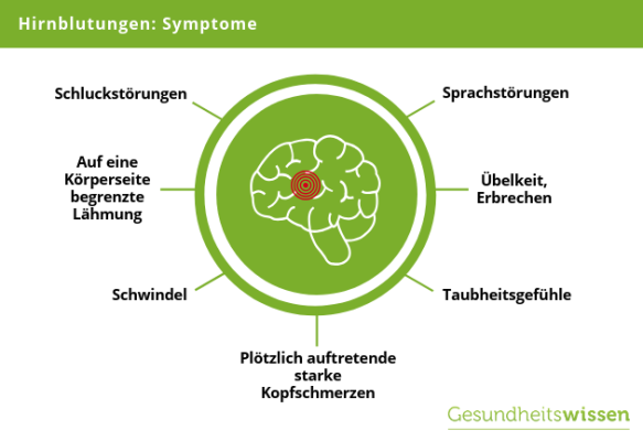 Wie Bekommt Man Eine Hirnblutung www.gesundheitswissen.de