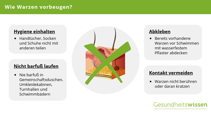 Wie kann man Warzen vorbeugen