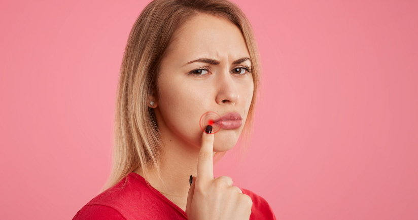 Herpes – Übertragung, Risikofaktoren, Symptome & Behandlung